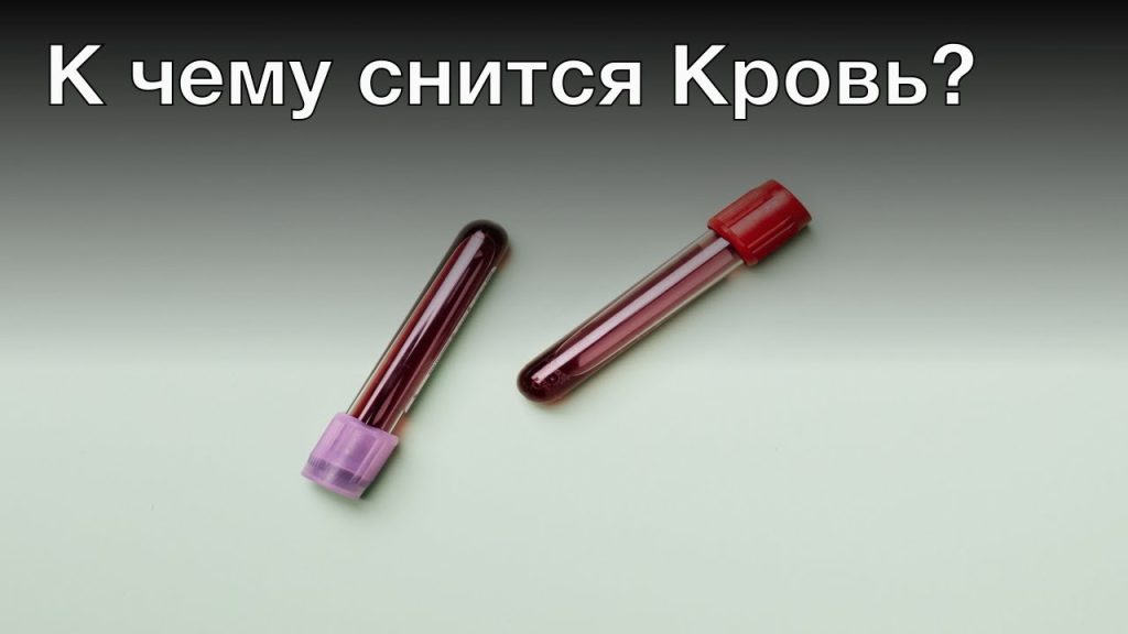 К Чему Снится Кровь: значение и толкование сна